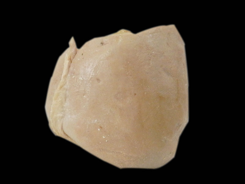 human liver plastinated specimen