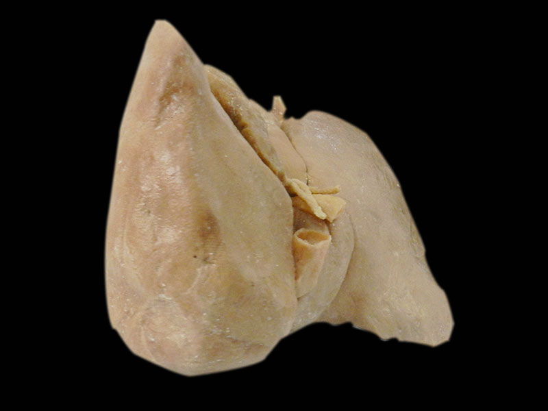human liver specimen