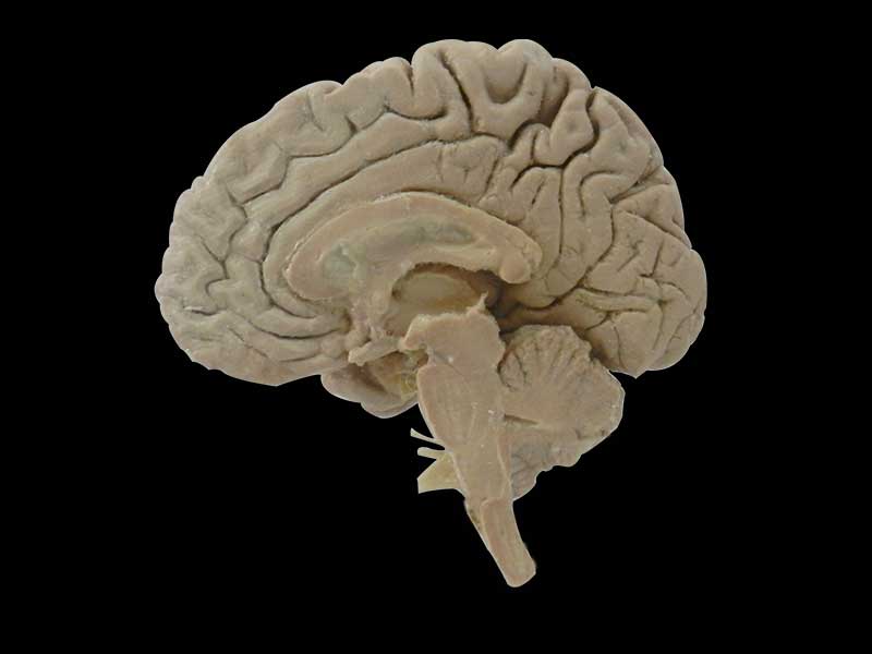 Human median sagittal section of brain