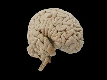 Human median sagittal section of brain