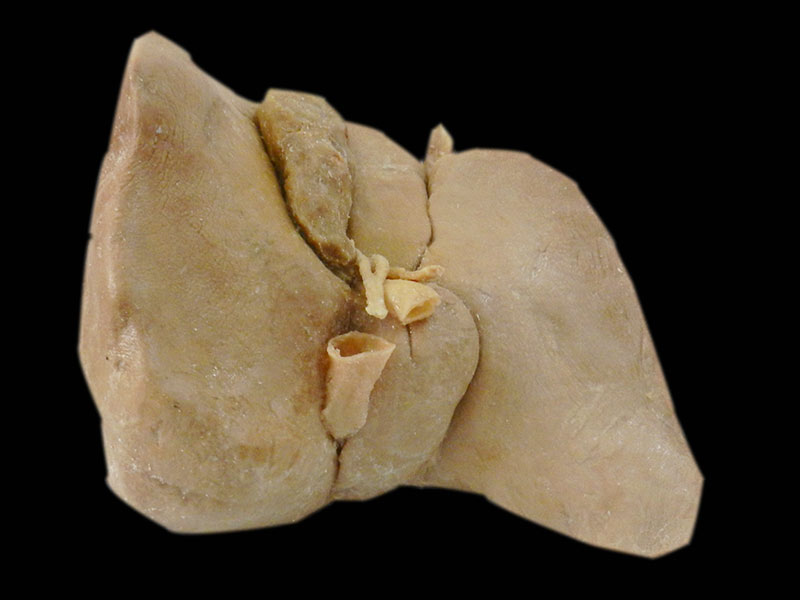 human medical liver specimen