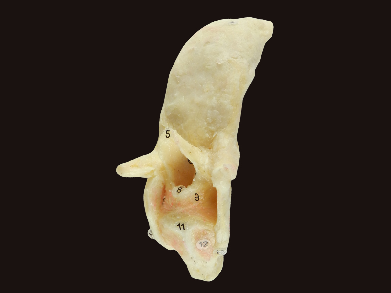 human specimen