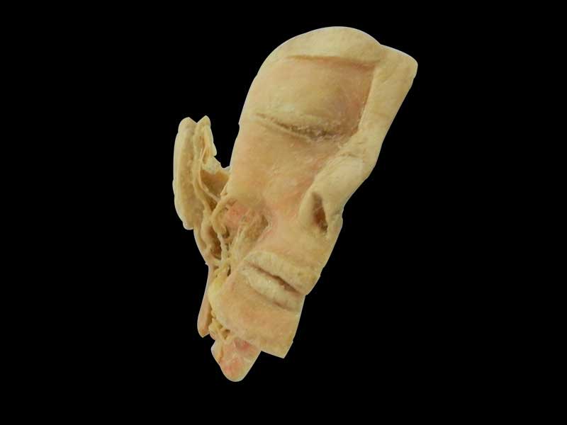 Human trigeminal nerve