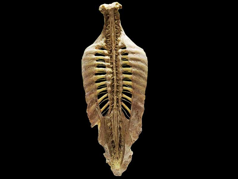 Human vertebral column plastination specimen