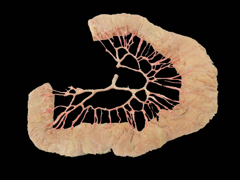 ileal vascular arch plastinated specimen