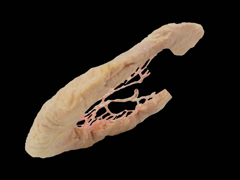ileal vascular arch specimen
