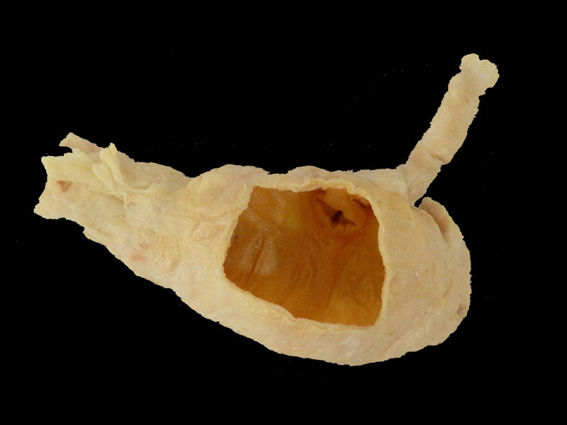 ileocecal junction plastination