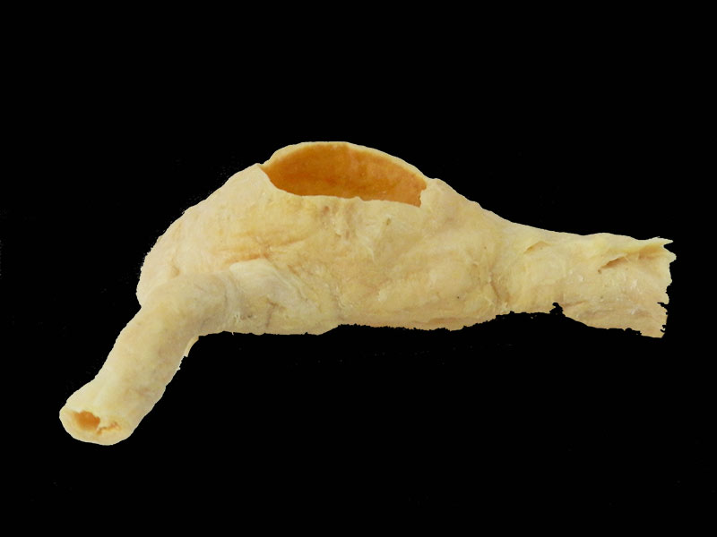ileocecal junction teaching specimen