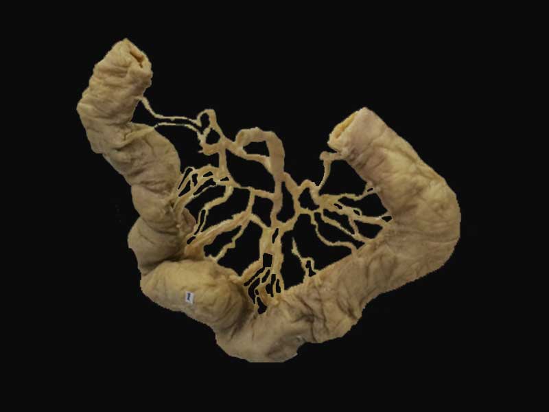 Ileum vascular arcades plastinated specimens (human anatomy specimens)