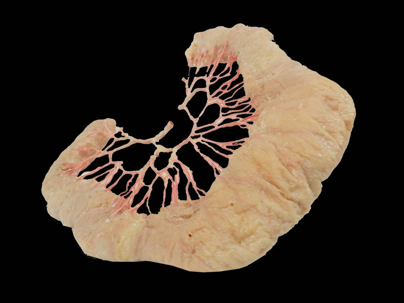 ileum vascular arch plastinated specimen