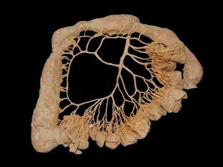 Inferior mesenteric artery plastinated specimen