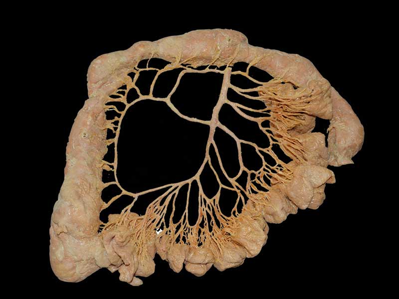 inferior mesenteric artery plastinated specimen