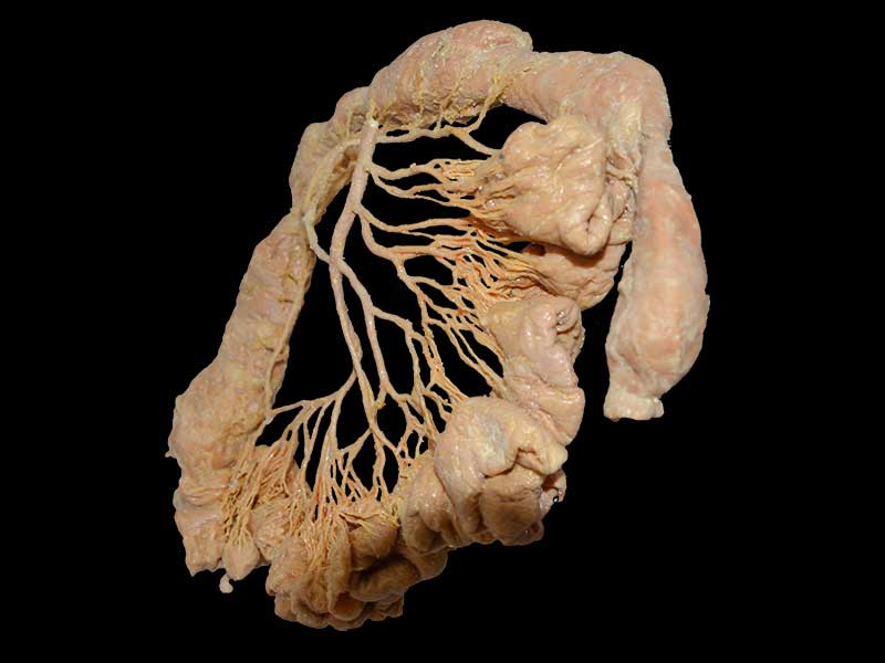 inferior mesenteric artery plastinated specimen price