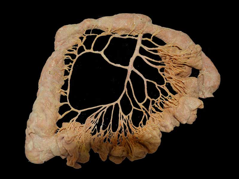 inferior mesenteric artery plastination