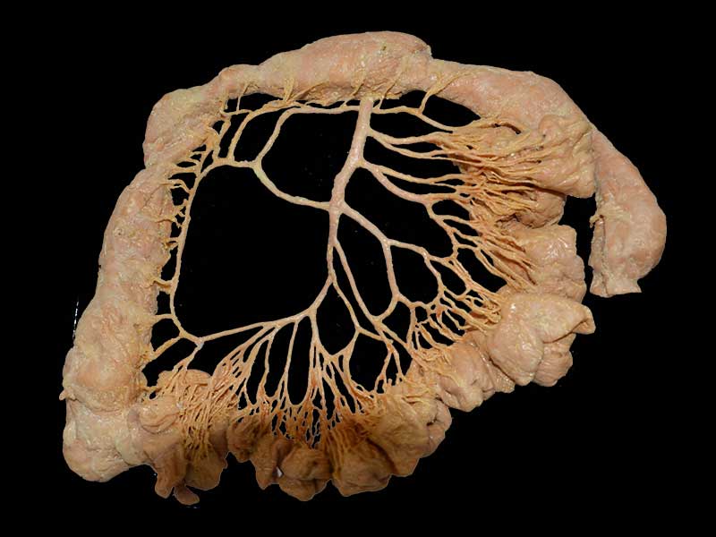 inferior mesenteric artery teaching specimen