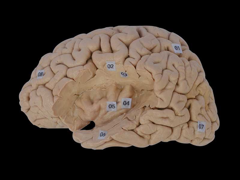 insular lobe plastinated specimen