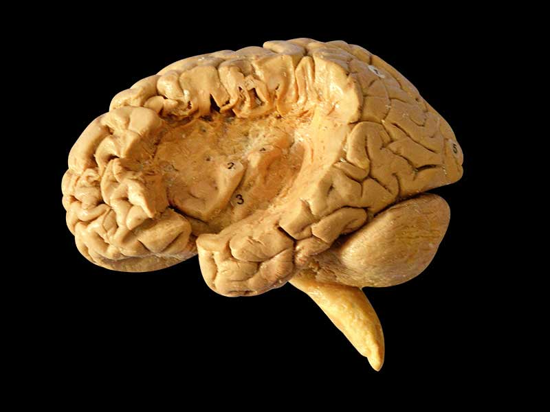 insular lobe