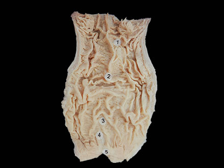 interior view of rectum specimen