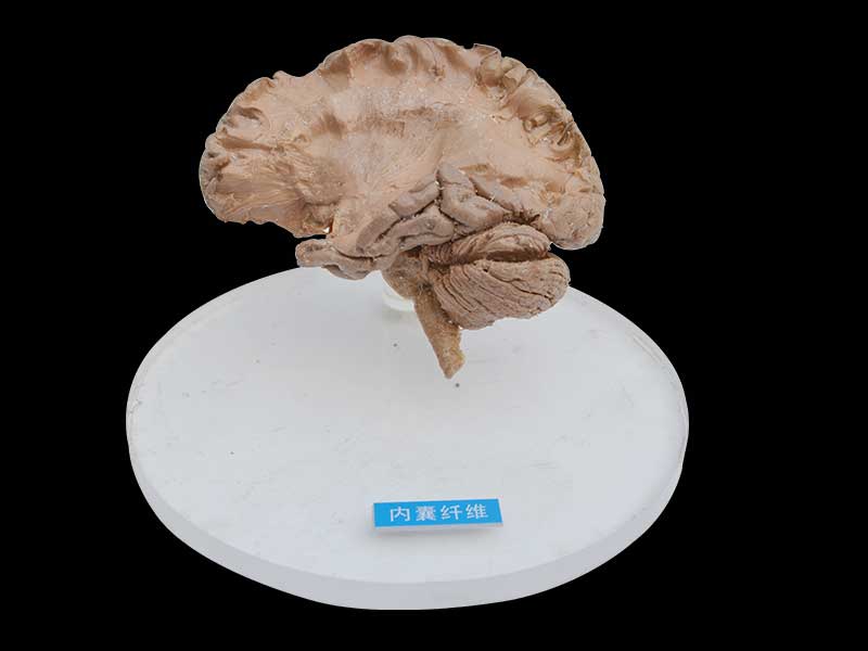 Internal capsule fiber plastinated specimen