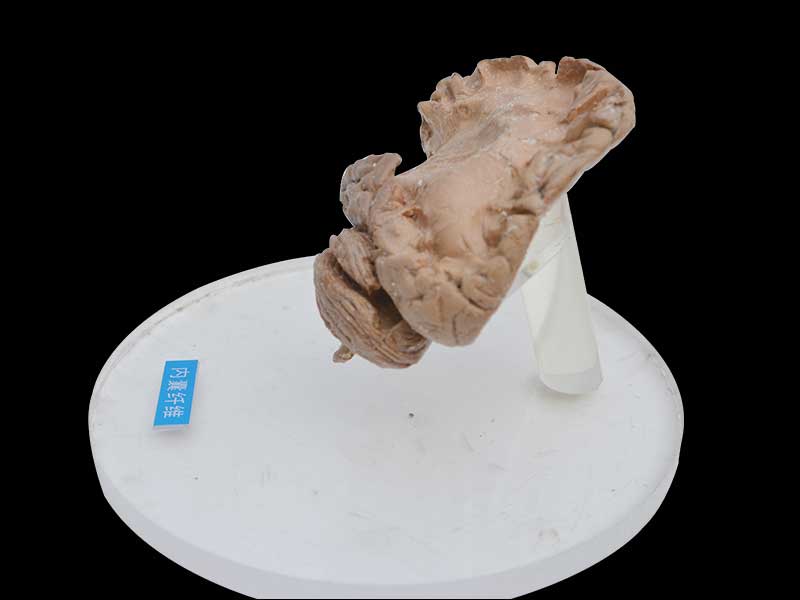 Internal capsule fiber plastination