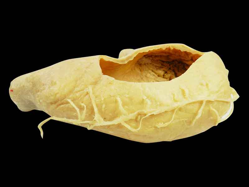 internal structure of stomach plastinated specimen