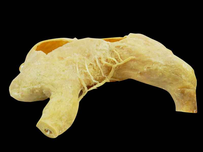 internal structure of stomach plastination