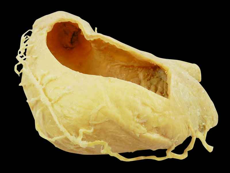 internal structure of stomach specimen for medical students
