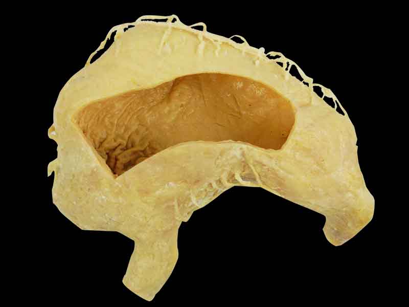 internal structure of stomach specimen