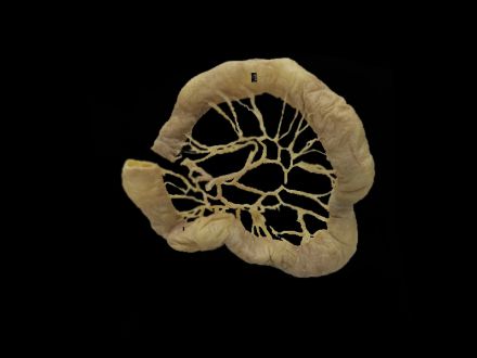 Jejunal vascular arcades plastinated specimens (anatomy specimens for sale) 