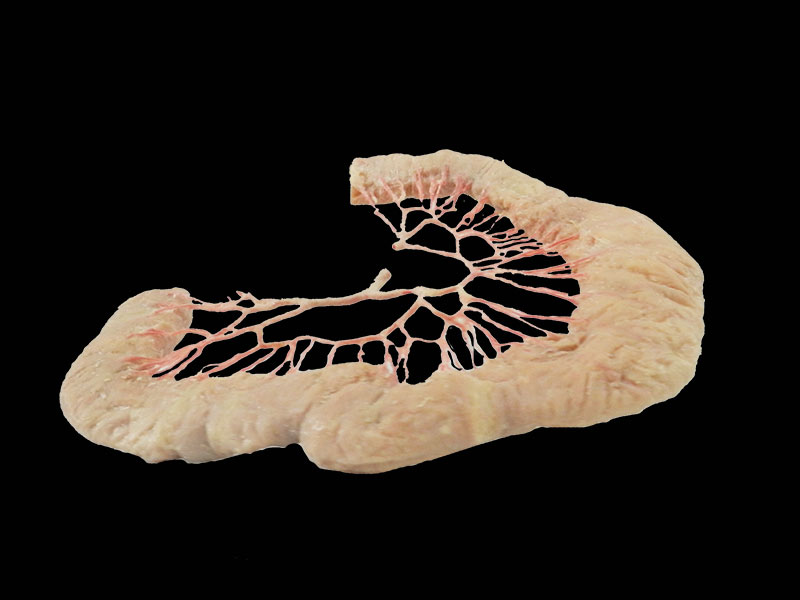 jejunal vascular arch plastinated specimen