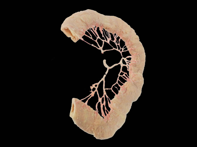 jejunal vascular arch plastination