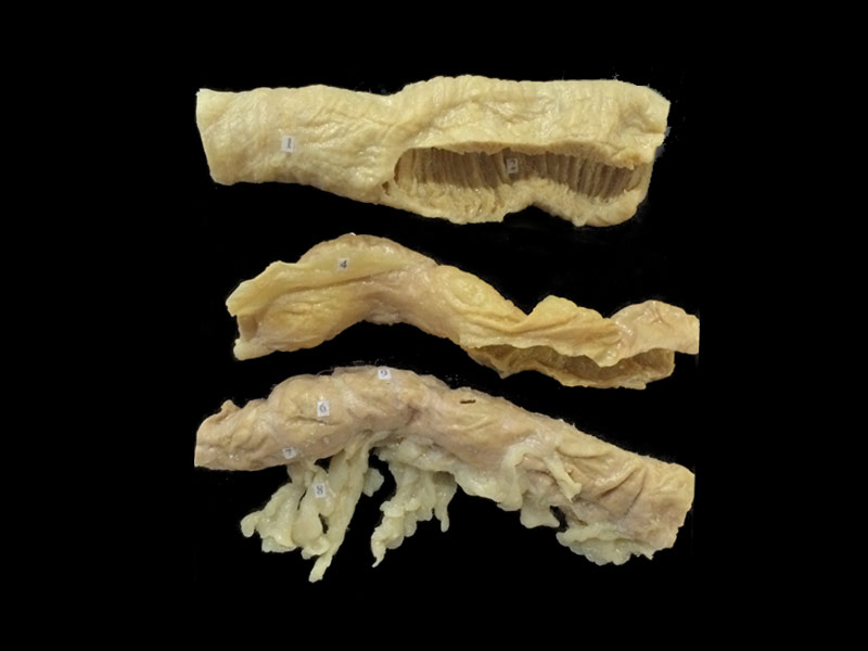 Jejunum ileum colon plastinated specimens(specimen anatomy )