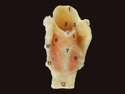 laryngeal muscle plastinated specimen