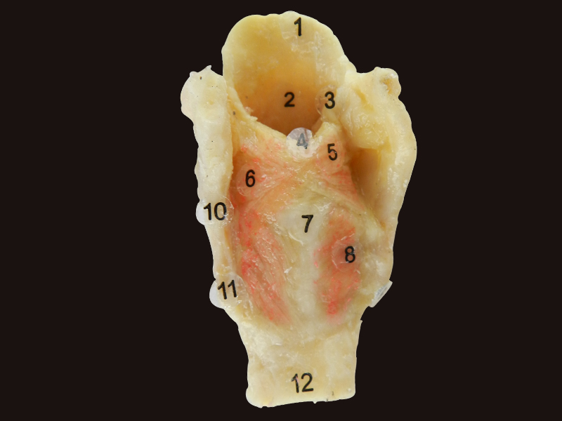 Laryngeal muscle plastination anatomy specimen