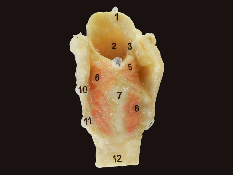 laryngeal muscle plastination specimen