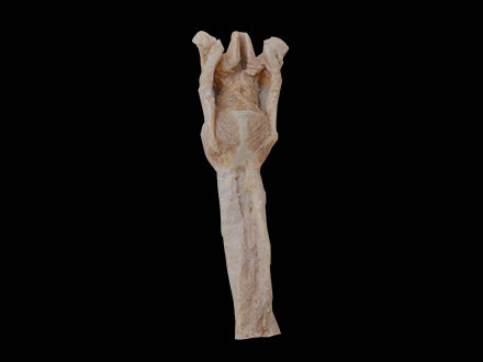 larynx plastinated specimen