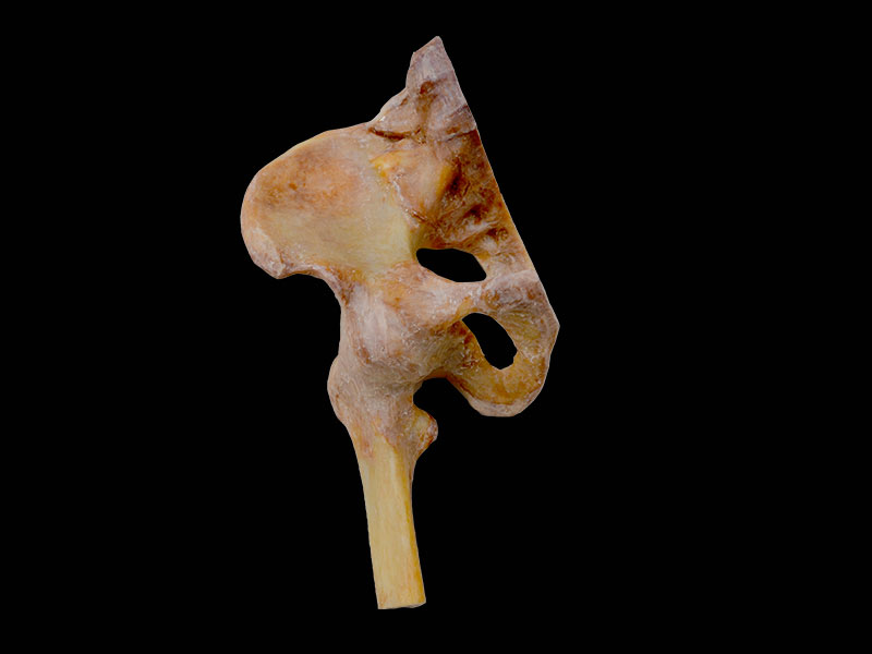 ligaments of pelvis