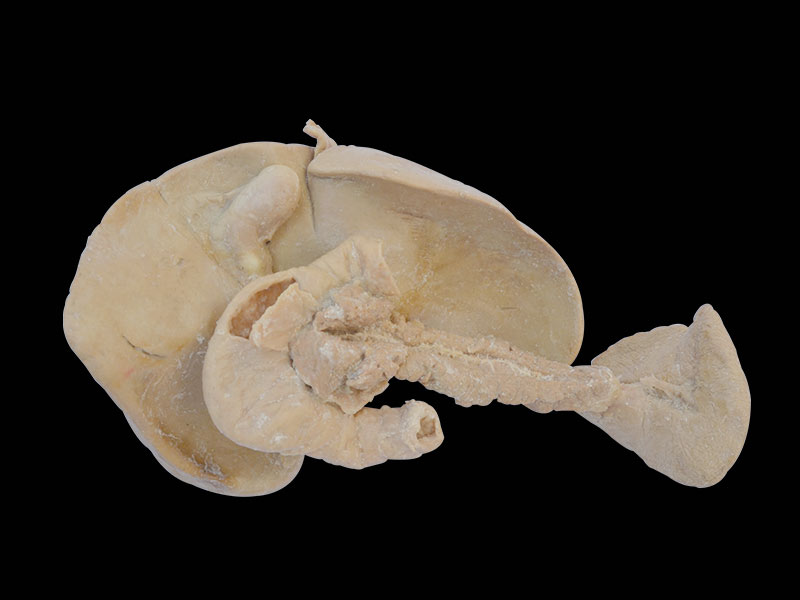 Liver pancreas duodenum spleen plastination