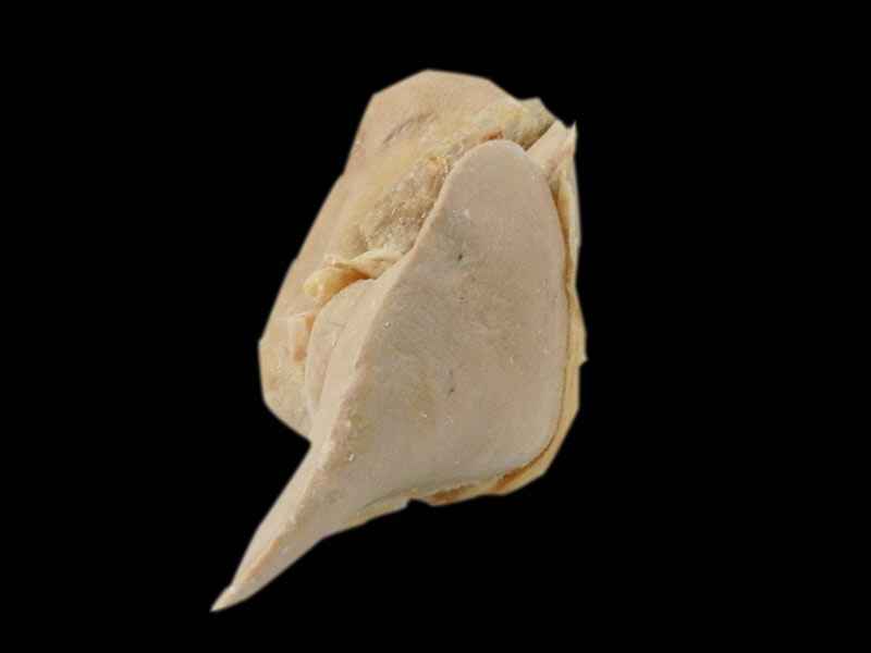 liver specimen plastination