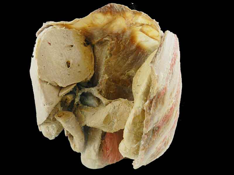 Liver spleen pancreas  and duodenum for sale