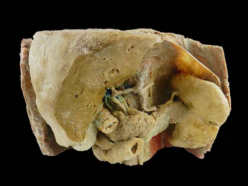 Liver spleen pancreas  and duodenum