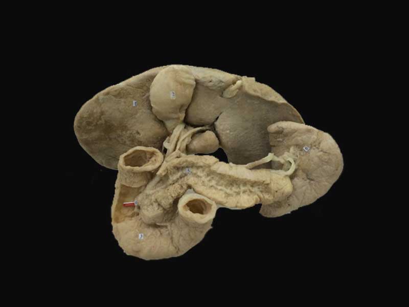 liver spleen pancreas and duodenum plastinated specimens(anatomy specimens)