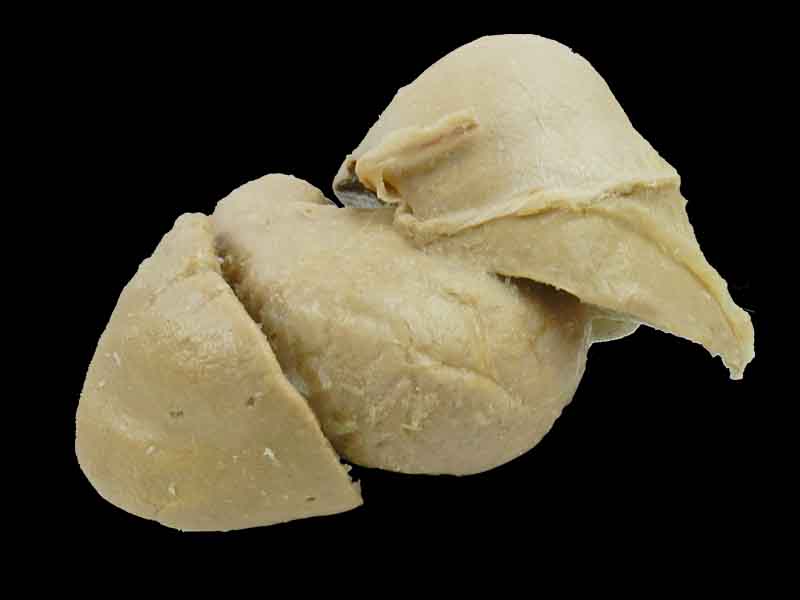 Liver stomach and spleen medical specimen