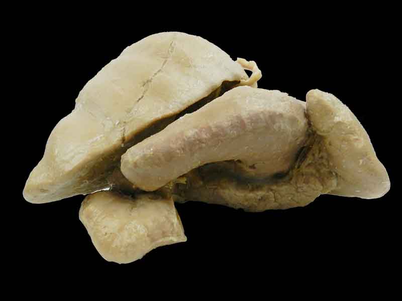 Liver stomach and spleen plastinated specimen