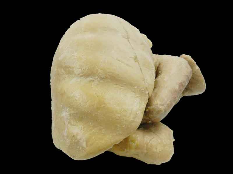 Liver stomach and spleen plastination