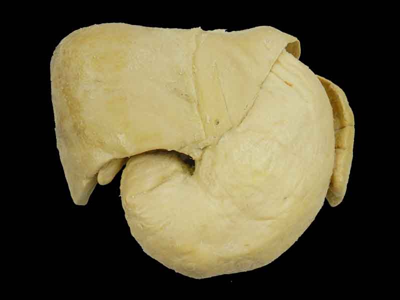 Liver stomach and spleen
