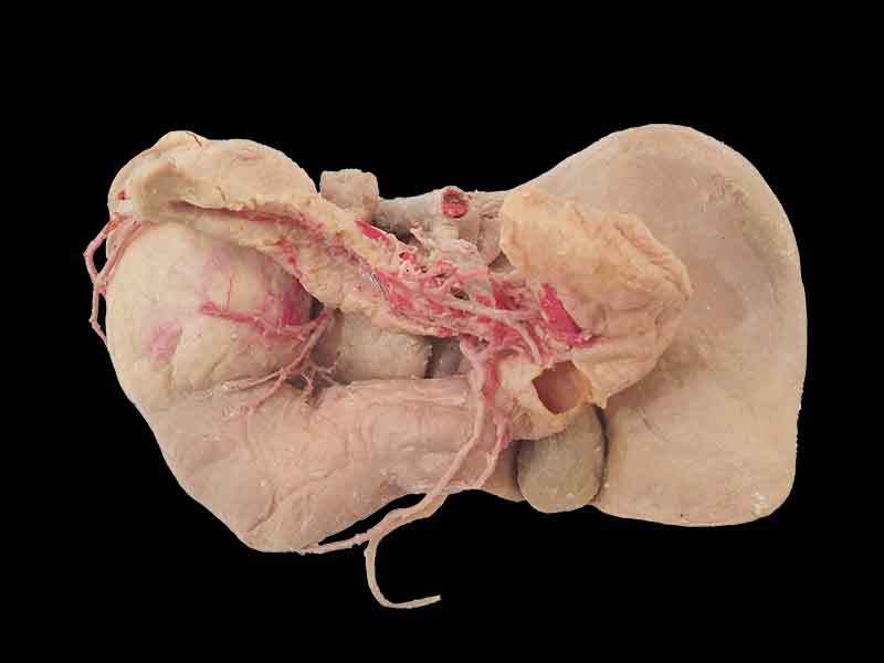Liver stomach pancreas and duodenum