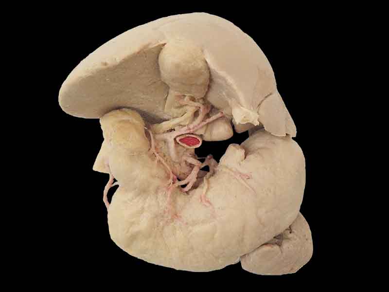 Liver stomach pancreas spleen and duodenum plastination