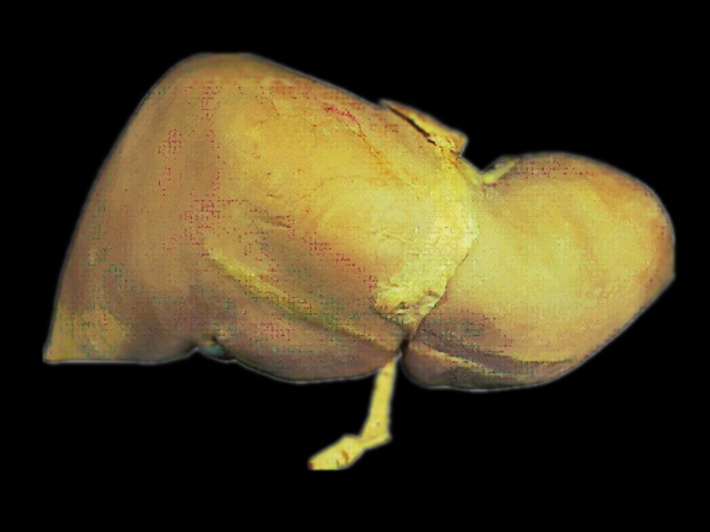 Liver plastinated specimens(anatomy specimen)