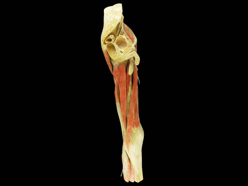 25cm  hip-mid leg